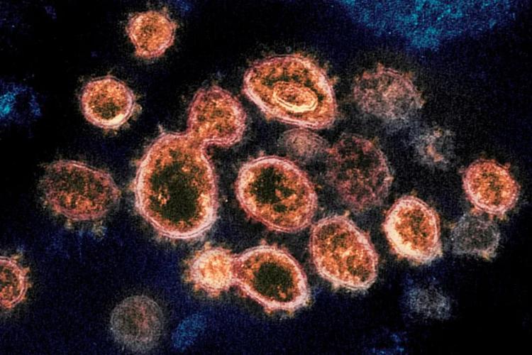 世界上最恐怖的十大病毒：埃博拉病毒致死率高达90%-第5张图片-飞扬号