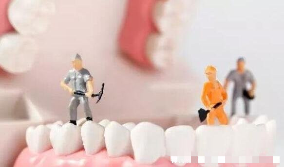 洗牙齿有什么好处和坏处（为什么医生不推荐洗牙）-第2张图片-飞扬号