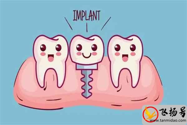 种植牙多少钱一颗（种植牙可以用医保报销吗）-第1张图片-飞扬号